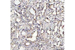 IHC analysis of SOCS5 using anti-SOCS5 antibody (ABIN7601562).