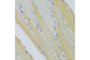 Immunohistochemistry of paraffin-embedded mouse skeletal muscle using CXCR3 Antibody. (CXCR3 抗体)