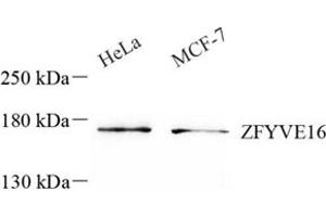 Western blot analysis of ZFYVE16 (ABIN7076283) at dilution of 1: 500 (ZFYVE16 抗体)