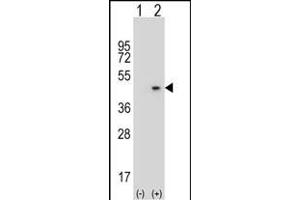 Western blot analysis of AZGP1 (arrow) using rabbit polyclonal AZGP1 Antibody (N-term) (ABIN390565 and ABIN2840895). (AZGP1 抗体  (N-Term))