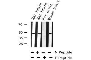Western Blotting (WB) image for anti-Gap Junction Protein, alpha 1, 43kDa (GJA1) (pSer368) antibody (ABIN6256297)