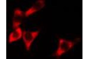 ABIN6274275 staining HeLa cells by IF/ICC. (BCAP31 抗体  (C-Term))