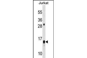 ATP5D Antibody (C-term) (ABIN1536694 and ABIN2848523) western blot analysis in Jurkat cell line lysates (35 μg/lane). (ATP5F1D 抗体  (C-Term))