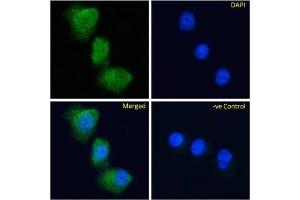 Immunofluoresence staining of fixed MDA-MB-231 cells with anti-Glucose-dependent insulinotropic receptor antibody Gipg013. (Recombinant G Protein-Coupled Receptor 119 抗体)