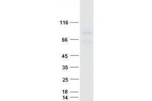 Western Blotting (WB) image for glycerophosphodiester phosphodiesterase Domain Containing 2 (GDPD2) protein (Myc-DYKDDDDK Tag) (ABIN2721786)