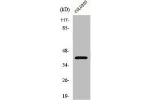 Western Blot analysis of COLO205 cells using GPR62 Polyclonal Antibody (GPR62 抗体  (Internal Region))