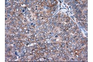 Immunohistochemical staining of paraffin-embedded Human Kidney tissue using anti-ACAT2 mouse monoclonal antibody. (ACAT2 抗体)