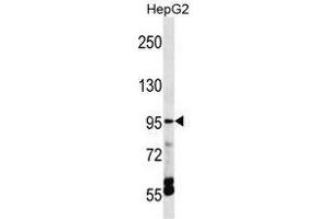 TRPV5 Antibody (C-term) western blot analysis in HepG2 cell line lysates (35 µg/lane). (TRPV5 抗体  (C-Term))