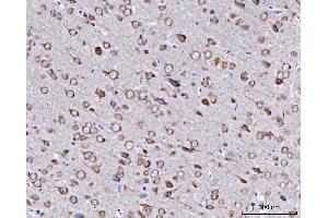 IHC analysis of BBS9 using anti-BBS9 antibody (ABIN7601518). (BBS9 抗体  (AA 37-793))