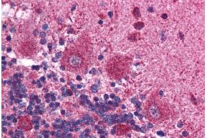 Human Brain, Cerebellum (formalin-fixed, paraffin-embedded) stained with MAPK14 antibody ABIN214794 at 2. (MAPK14 抗体  (C-Term))