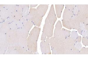 Immunohistochemistry (IHC) image for anti-Lipolysis Stimulated Lipoprotein Receptor (LSR) (AA 335-589) antibody (ABIN7435571)