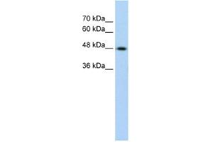 WB Suggested Anti-KRT17 Antibody Titration:  0. (KRT17 抗体  (C-Term))