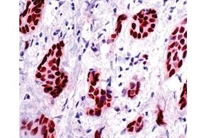Immunohistochemistry (IHC) image for anti-Progesterone Receptor (PGR) (AA 412-526) antibody (ABIN6655214)