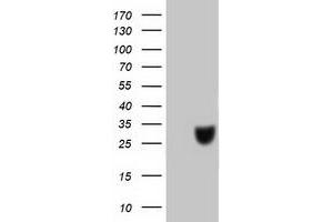 Western Blotting (WB) image for anti-Chromosome 20 Open Reading Frame 43 (C20orf43) antibody (ABIN1497038) (C20orf43 抗体)
