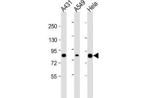 All lanes : Anti-PLA2G4D Antibody (C-Term) at 1:2000 dilution Lane 1: A431 whole cell lysate Lane 2: A549 whole cell lysate Lane 3: Hela whole cell lysate Lysates/proteins at 20 μg per lane. (PLA2G4D 抗体  (AA 754-786))