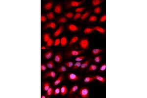 Immunofluorescence analysis of U2OS cells using ZEB1 antibody (ABIN5973261). (ZEB1 抗体)