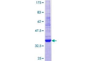 CNIH Protein (AA 1-144) (GST tag)