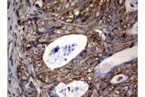 Image no. 3 for anti-3-Oxoacyl-ACP Synthase, Mitochondrial (OXSM) (AA 78-343) antibody (ABIN1491676) (OXSM 抗体  (AA 78-343))