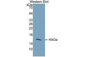 Western blot analysis of the recombinant protein. (WISP1 抗体  (AA 216-347))