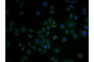 Immunofluorescence staining of A549 cells with ABIN7148235 at 1:100, counter-stained with DAPI. (COL18A1 抗体  (AA 1600-1754))
