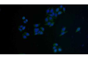 Detection of FAS in Human MCF7 cell using Polyclonal Antibody to Factor Related Apoptosis (FAS) (FAS 抗体  (AA 22-169))