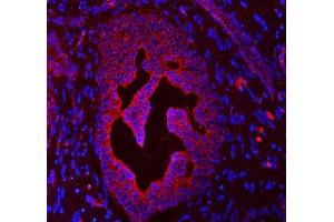 IF analysis of Cytokeratin 4/KRT4 using anti-Cytokeratin 4/KRT4 antibody (ABIN7600283).