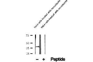 Western blot analysis of extracts of HeLa cells treated with nocodazole , using Phospho-NPM (Thr95) Antibody.