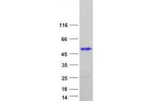 Western Blotting (WB) image for T-Box 1 (TBX1) (Transcript Variant A) protein (Myc-DYKDDDDK Tag) (ABIN2733302)