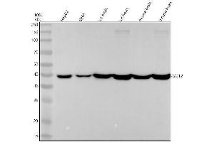 Western blot analysis of GOT2 using anti-GOT2 antibody (ABIN7605007).