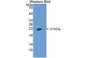 Detection of Recombinant THOP1, Human using Polyclonal Antibody to Thimet Oligopeptidase 1 (THOP1) (Thimet Oligopeptidase 1 抗体  (AA 451-597))