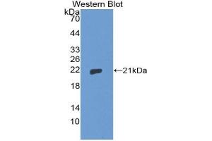 Detection of Recombinant THOP1, Human using Polyclonal Antibody to Thimet Oligopeptidase 1 (THOP1) (Thimet Oligopeptidase 1 抗体  (AA 451-597))