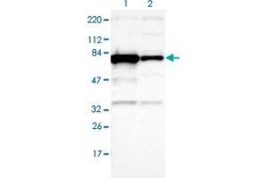 Western blot analysis of Lane 1: Human cell line RT-4 Lane 2: Human cell line U-251MG sp with OPTN polyclonal antibody  at 1:100-1:250 dilution. (OPTN 抗体)