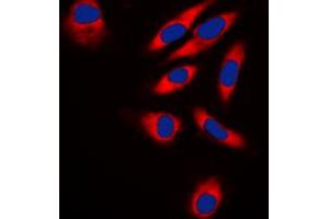 Immunofluorescent analysis of TRAF3IP1 staining in HeLa cells. (TRAF3IP1 抗体  (Center))