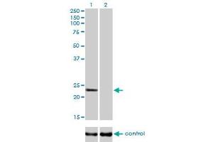 Western blot analysis of RAB9A over-expressed 293 cell line, cotransfected with RAB9A Validated Chimera RNAi (Lane 2) or non-transfected control (Lane 1). (RAB9A 抗体  (AA 17-115))
