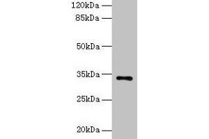 Western blot All lanes: NAT2 antibody at 6 μg/mL + Mouse brain tissue Secondary Goat polyclonal to rabbit IgG at 1/10000 dilution Predicted band size: 34 kDa Observed band size: 34 kDa (NAT2 抗体  (AA 1-290))