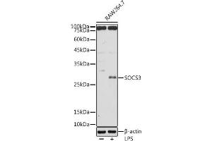 Western blot analysis of extracts of R. (SOCS3 抗体  (C-Term))