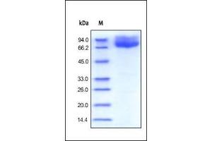 SDS-PAGE (SDS) image for CD86 (CD86) (AA 26-247) (Active) protein (Fc Tag) (ABIN2180621)