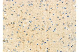 ABIN6265743 and ABIN6273181 at 1/100 staining Mouse brain tissue by IHC-P.