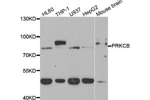 Western blot analysis of extracts of various cell lines, using PRKCB antibody (ABIN5973456) at 1/1000 dilution. (PKC beta 抗体)