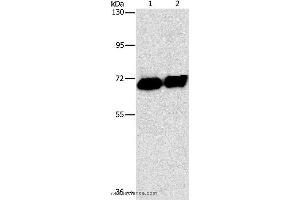 Western blot analysis of HepG2 cell and human placenta tissue, using ALPP Polyclonal Antibody at dilution of 1:1550 (PLAP 抗体)