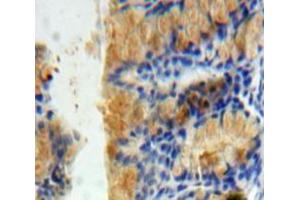 Immunohistochemistry (IHC) image for anti-Protein Interacting With Protein Kinase C, alpha 1 (PICK1) (AA 24-229) antibody (ABIN1860209)