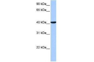 CC2D1B antibody used at 1 ug/ml to detect target protein. (CC2D1B 抗体  (C-Term))