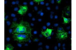 Image no. 1 for anti-ATG3 Autophagy Related 3 (ATG3) antibody (ABIN1496762) (ATG3 抗体)