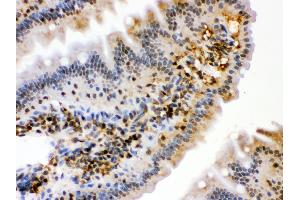 Immunohistochemistry (IHC) image for anti-Heat Shock 70kDa Protein 2 (HSPA2) (AA 564-598), (C-Term) antibody (ABIN3043850)