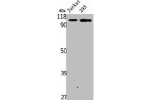 Western Blot analysis of Jurakt 293 cells using Plakophilin 2 Polyclonal Antibody (Plakophilin 2 抗体  (C-Term))