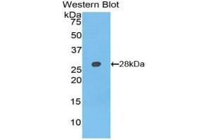 Detection of Recombinant AXIN, Rat using Polyclonal Antibody to Axis Inhibition Protein (AXIN) (Axin 抗体  (AA 618-827))