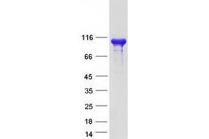 Western Blotting (WB) image for Cap Methyltransferase 1 (CMTR1) protein (Myc-DYKDDDDK Tag) (ABIN2721441)