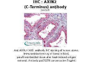 Image no. 2 for anti-Axin 2 (AXIN2) antibody (ABIN1732157) (AXIN2 抗体)