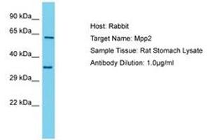 Image no. 1 for anti-Membrane Protein, Palmitoylated 2 (MAGUK P55 Subfamily Member 2) (MPP2) (C-Term) antibody (ABIN6750363) (MPP2 抗体  (C-Term))