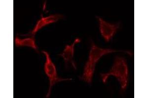 ABIN6275570 staining Hela cells by IF/ICC. (SHC2 抗体  (Internal Region))